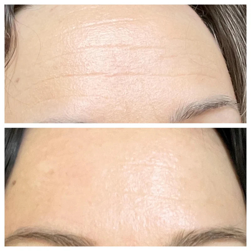- 4% Retinal Liposome Facial Treatment